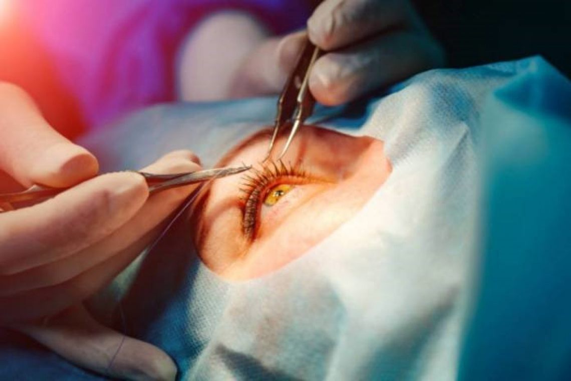    Authorities work to clear cataract surgery backlog