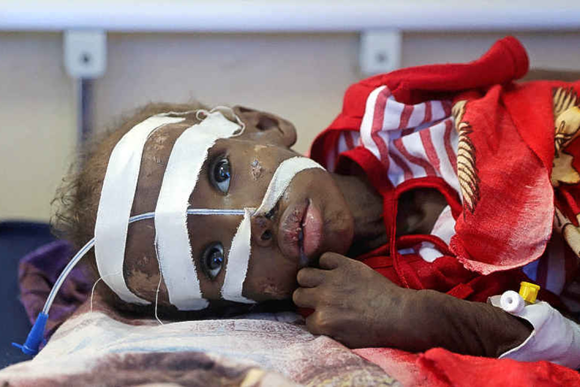 Child malnutrition soars in central Somalia area on verge of famine