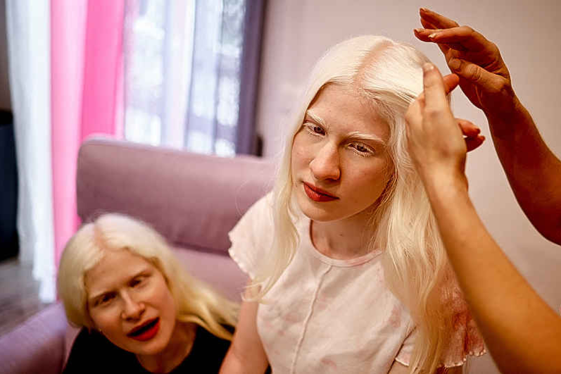 Teenage sisters with albinism must take extra care in Rome heatwave 